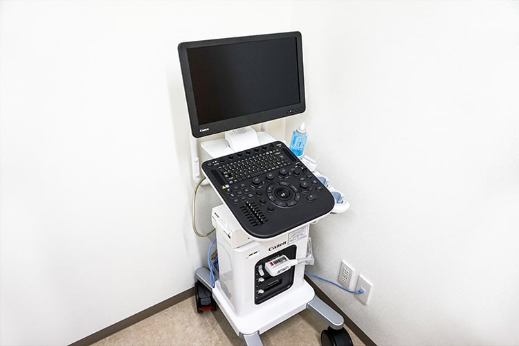 超音波診断装置